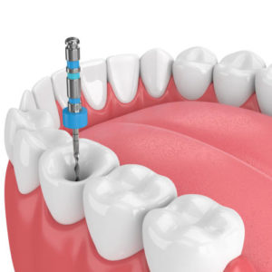 Endodontie