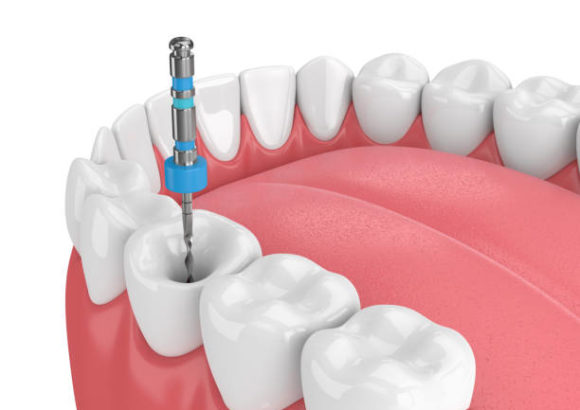 Endodontie